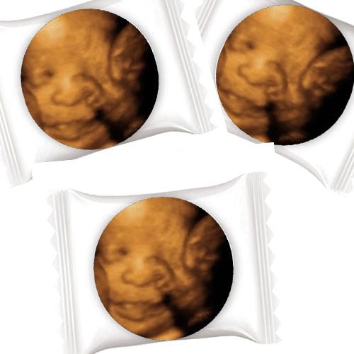 50 Add Your Sonogram Photograph Personalized Individual Mint Favors - Favors Today