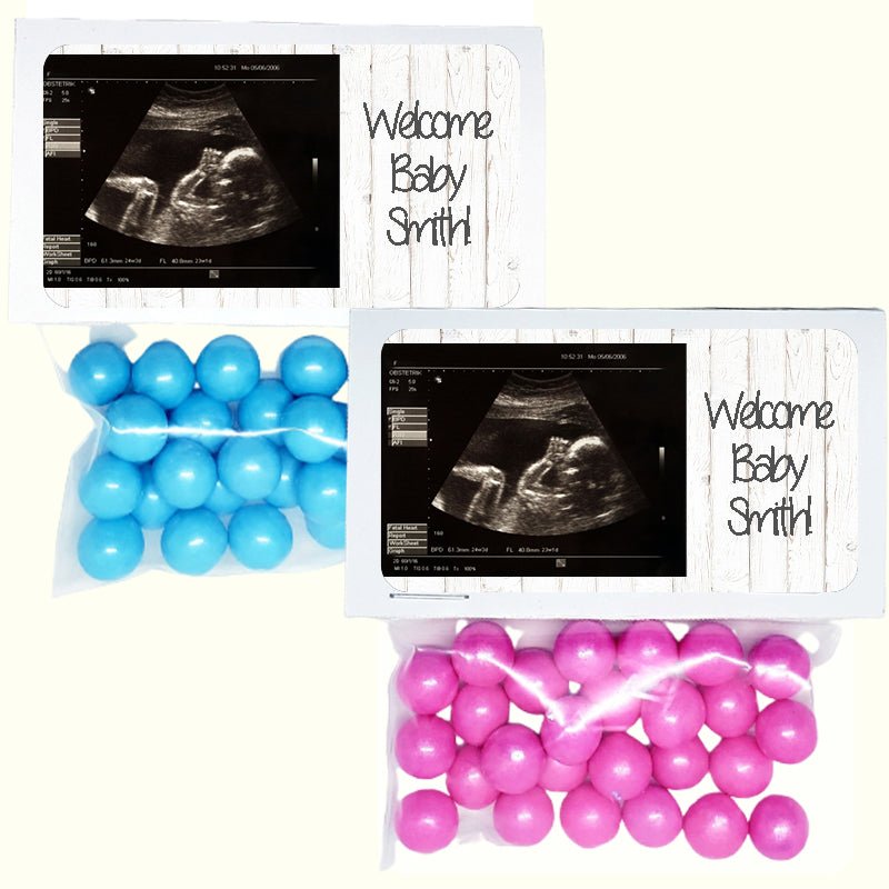Personalized Add Your Sonogram Photo Custom Treat Favor Bag and Topper - Favors Today